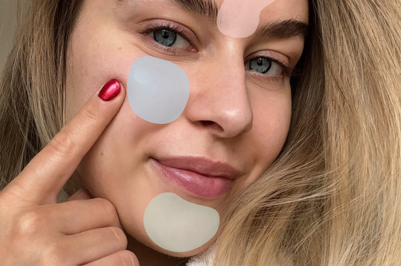 Vysvětlení umístění akné